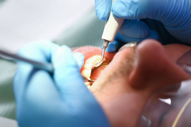 Best Emergency Broken Tooth Repair in Idaho Springs, CO